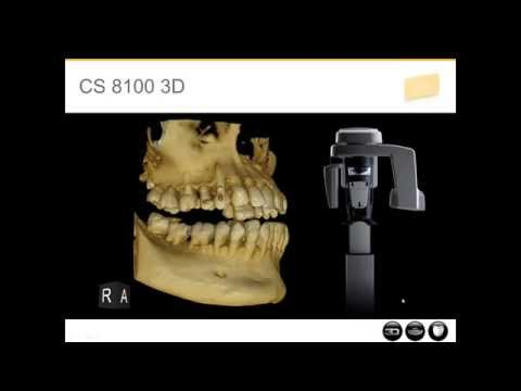 3D Scanner 8100