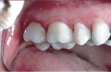 case1-after.jpg