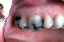 case1-before.jpg