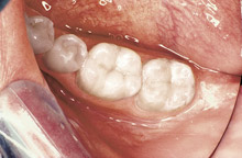 case2-after.jpg