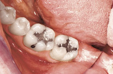 case2-before.jpg