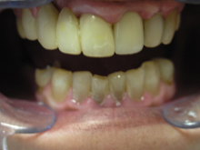 patient6-1b