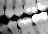xray